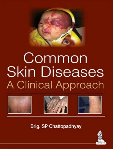 Common Skin Diseases