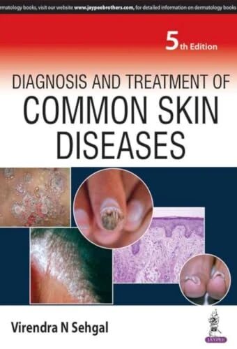 Diagnosis and Treatment of Common Skin Diseases