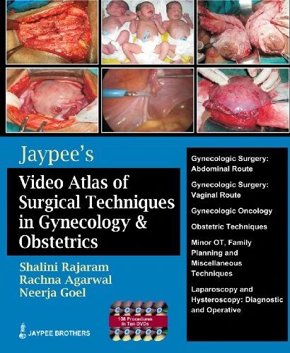 Jaypee Video Atlas of Surgical Techniques in Gynecology and Obstetrics (with 10 DVD Roms)