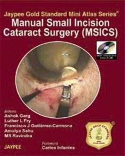 Manual Small Incision Cataract Surgery (with DVD Rom) (Jaypee Gold Standard Mini Atlas Series)
