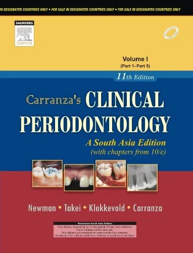 Newman Carranza's Clinical Periodontology