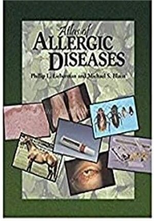 Atlas of Allergic Diseases