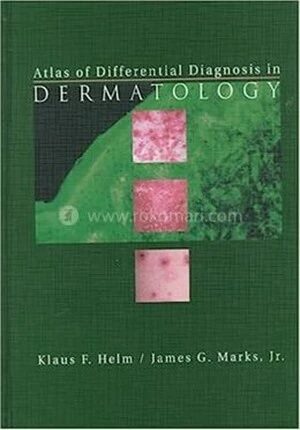 Atlas of Differential Diagnosis in Dermatology