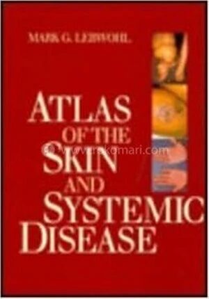 Atlas of the Skin and Systemic Disease