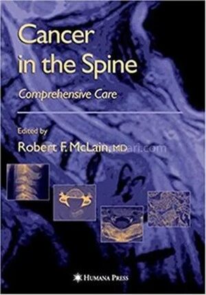 Cancer in the Spine