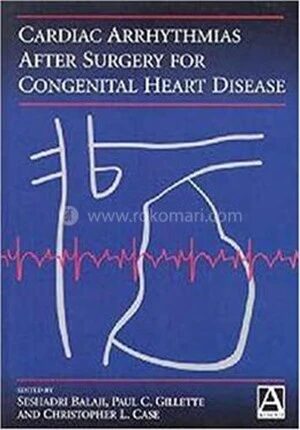 Cardiac Arrhythmias After Surgery for Congenital Heart Disease