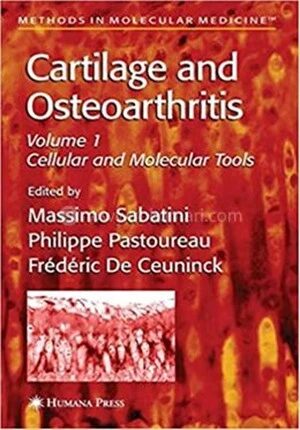 Cartilage and Osteoarthritis