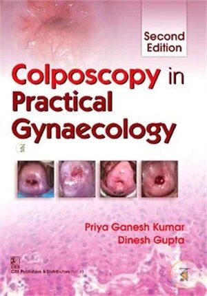 Colposcopy in Practical Gynecology