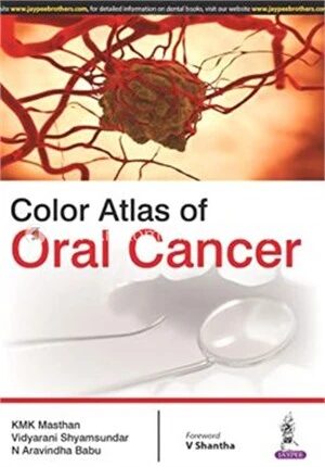 Color Atlas of Oral Cancer