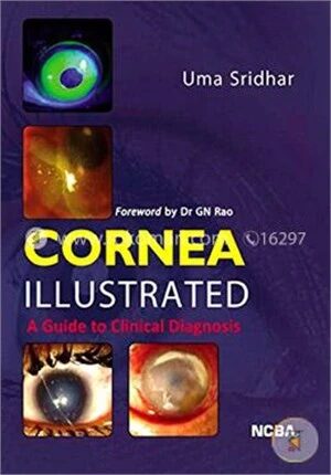 Cornea Illustrated